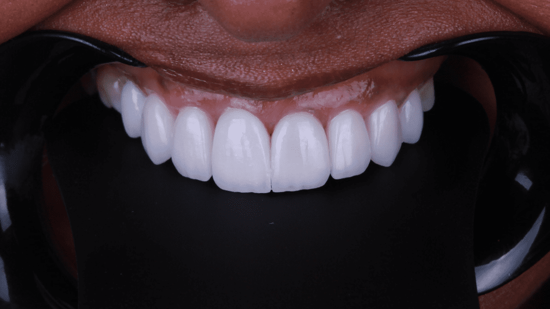 d1